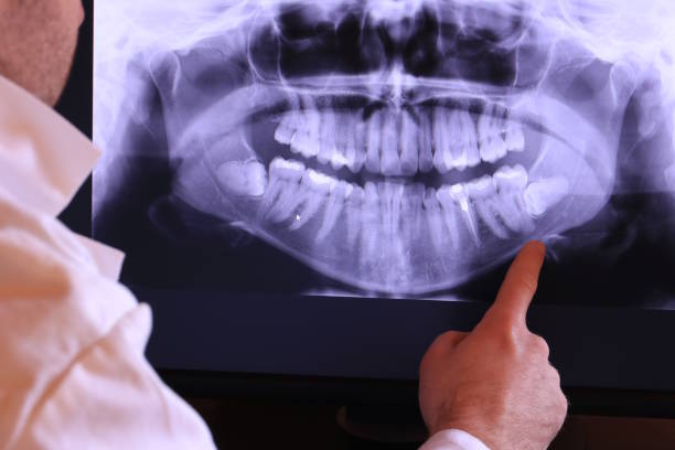 Best Emergency Treatment for Dental Infections or Abscesses in Piney Green, NC