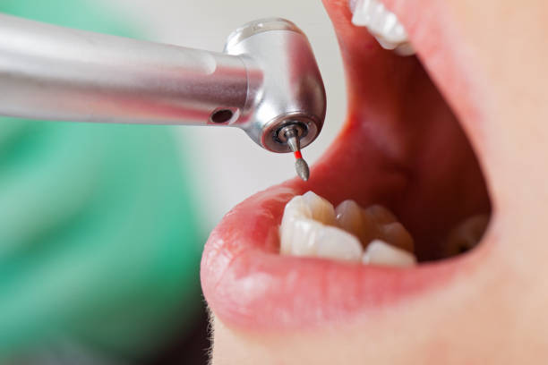 Best Emergency Gum Treatment in Piney Green, NC